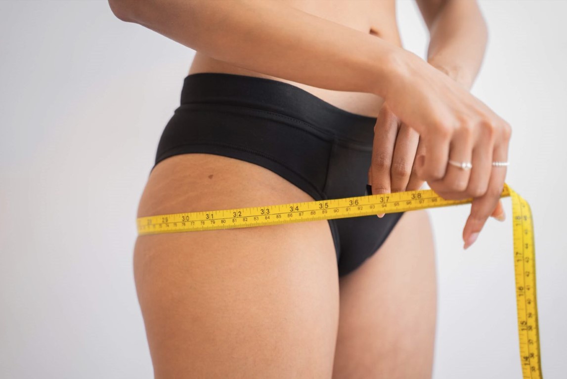 Lipoescultura láser en Valle del Cauca (Colombia): un tratamiento eficaz para reducir grasa no deseada