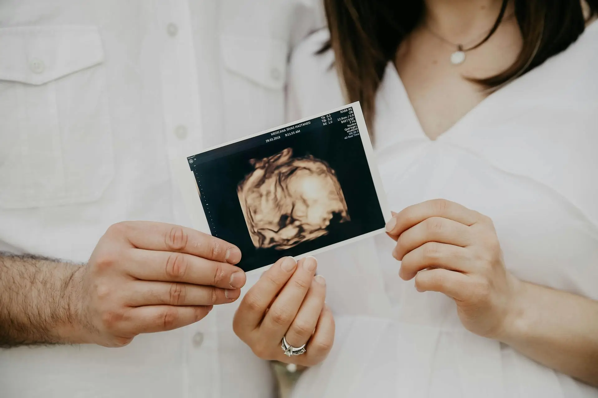 Criopreservación si eres de España: preserva tu fertilidad para el futuro con Babynova
